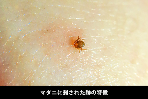 ダニ刺され?ノミ刺され?若しくはアレルギー? , イエダニに刺されたときの症状とは?治療法や駆除方法を紹介 – KUMWQR