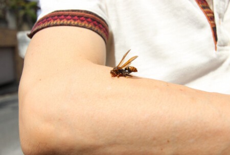蜂に刺された!?刺された時の2つの症状