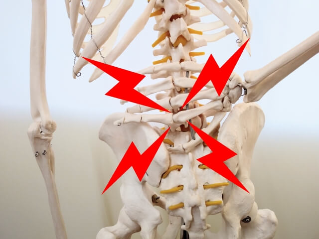【ぎっくり腰と整体】ぎっくり腰の症状と原因を知ろう!
