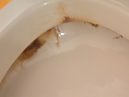 サニタリーシャイン：究極のトイレ徹底洗浄と抗菌コーティング完全サービスです☆のサービス写真2